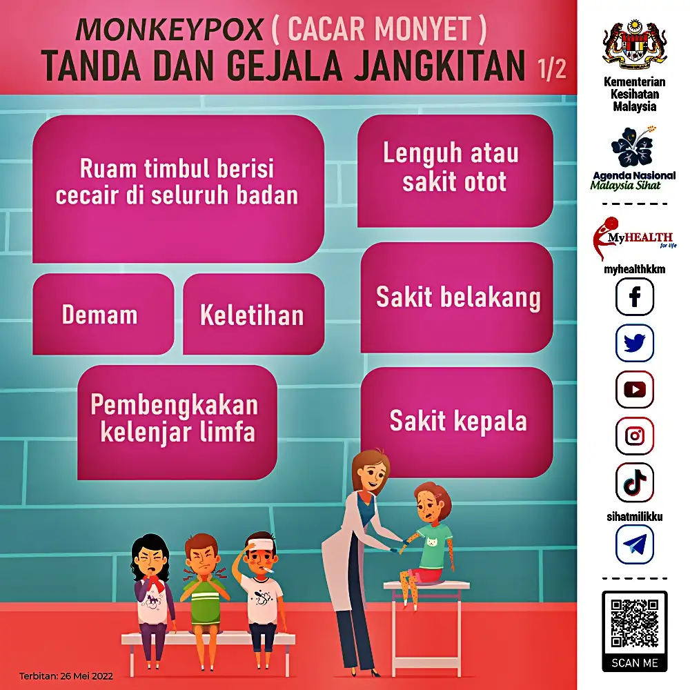 simptom tanda monkeypox